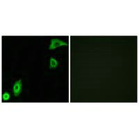 RPS20 Antibody