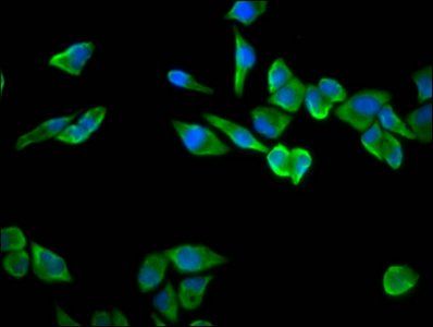 RPS23 antibody