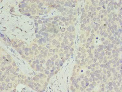RPS28 Antibody
