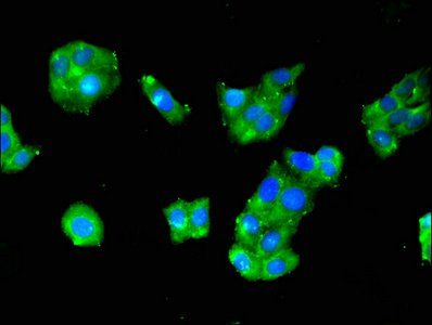 RPS29 Antibody