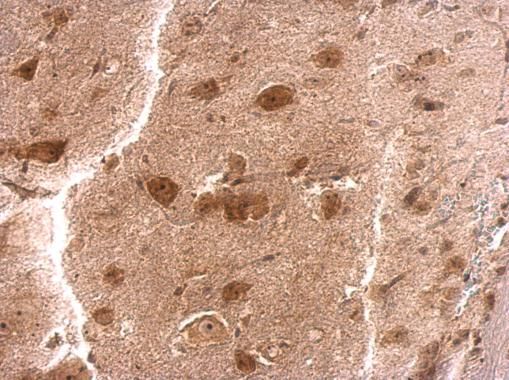RPS3A Rabbit Polyclonal Antibody
