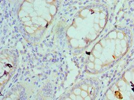 RPS4X Antibody