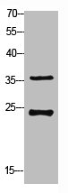 RPS4X Antibody