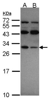 RPS4X antibody