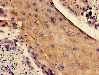 RPS4Y1 Antibody