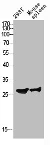 RPS4Y1 Antibody