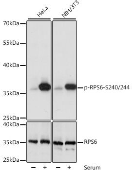 RPS6 (Phospho-S240/244) antibody