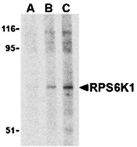 RPS6K1 Antibody