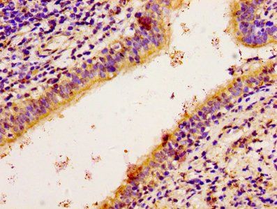 RPS6KA2 Antibody