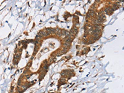 RPS6KA2 Antibody