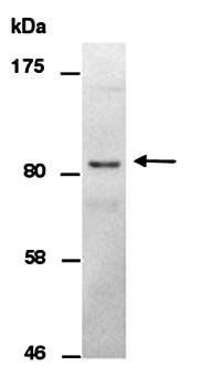 RPS6KA3 (N) Antibody, Rabbit Polyclonal