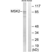 RPS6KA4 (Ab-568) Antibody