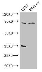 RPS6KA4 Antibody