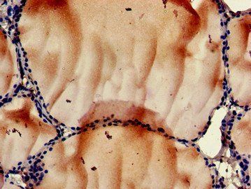 RPS6KA5 Antibody