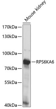 RPS6KA6 antibody