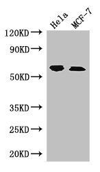 RPS6KB1 antibody