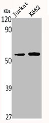 RPS6KB2 Antibody