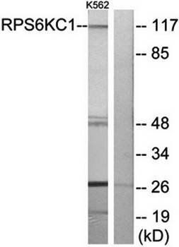RPS6KC1 Antibody