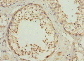 RPS6KL1 Antibody