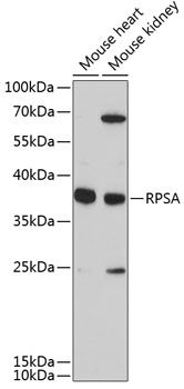 RPSA antibody