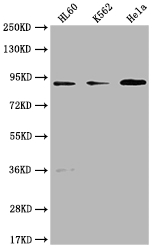 RPTN antibody