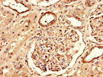 RPTOR Antibody