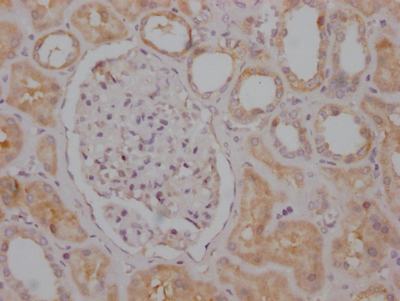 RPTOR Recombinant Monoclonal Antibody