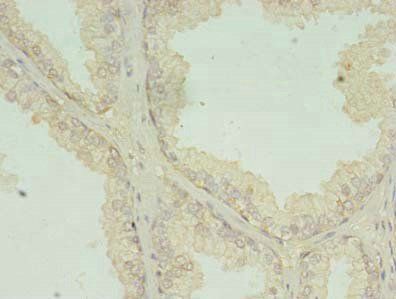 CNOT9 Antibody