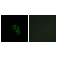 RRAD Antibody