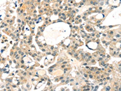 RRAGA Antibody