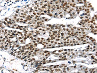 RRAS Antibody