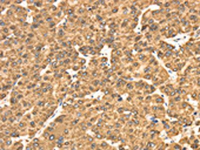 RRBP1 Antibody