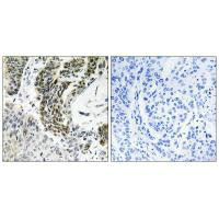 RREB1 Antibody