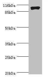 RRM1 Antibody
