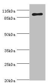 RRM1 Antibody