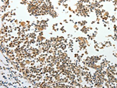 RRM1 Antibody