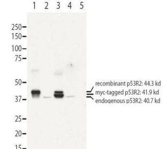 RRM2B p53R2 antibody
