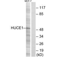RRP8 Antibody