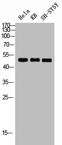 RRS1 antibody