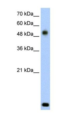 RSAD2 antibody