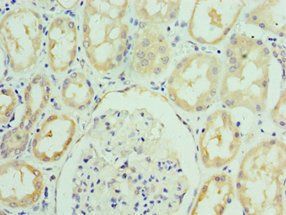 RSAD2 Antibody