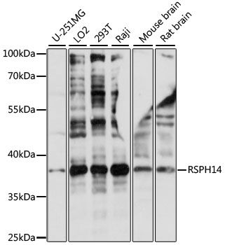 RSPH14 antibody