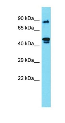 RSPH4A antibody