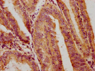 PHF7 Antibody