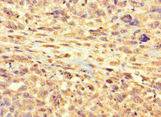 RSPH9 Antibody