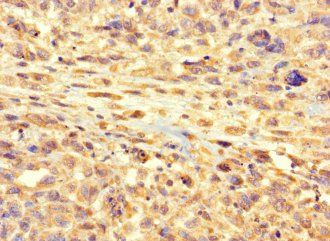 RSPH9 antibody