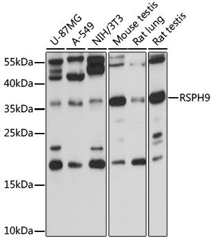 RSPH9 antibody