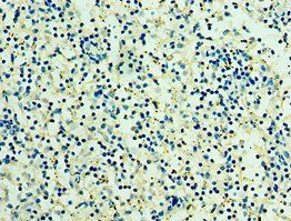 RSPO1 Antibody