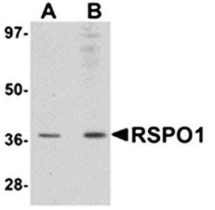 RSPO1 Antibody