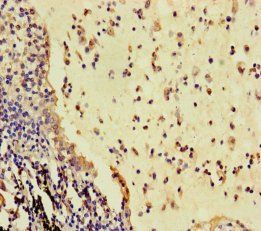 RSPO3 Antibody